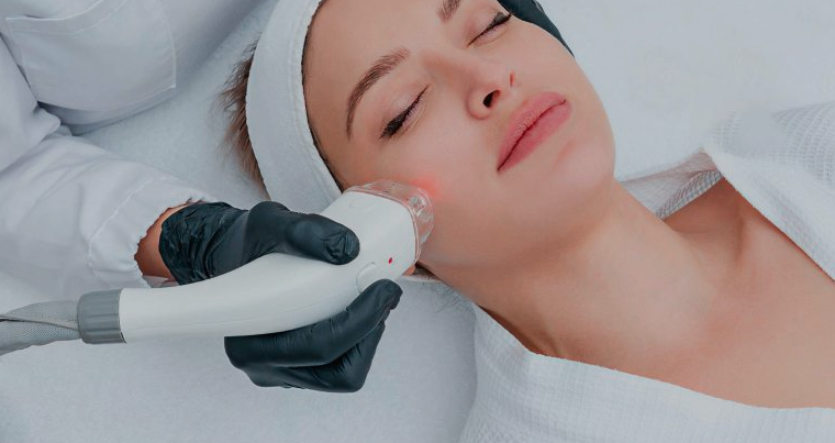 Why RF Facial Treatment Is the Best Non-Surgical Skin Tightening Option in 2025