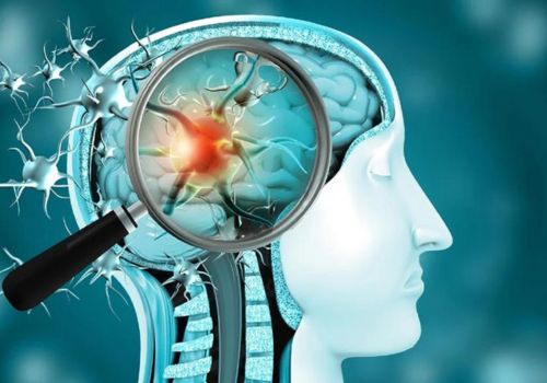 Ayurveda Neurological Treatment in Sharjah Dubai - Drherbsayurvedic