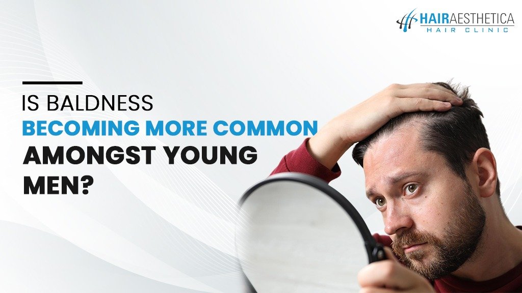Is Baldness Becoming More Common Amongst Young Men