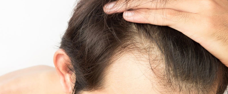 Best Hair Doctor | Specialist in Ghaziabad | Hair Transplant