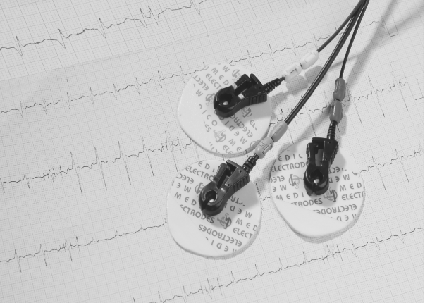 Which Adhesive Gel is Ideal for TENS and EMS Pads?